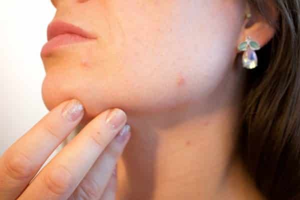 La importancia de un buen dermatólogo para la salud de la piel